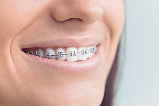 Best Invisalign and Clear Aligners  in Crystal Lake, IL
